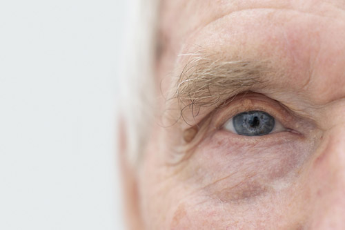 Katarak Mengganggu Penglihatan? Pahami Penyebab, Gejala, dan Solusi Pengobatan Efektif!