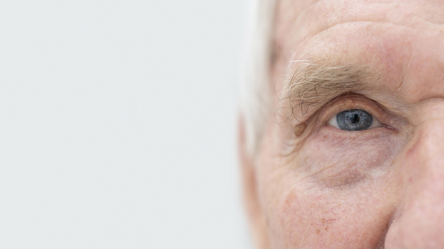 Katarak Mengganggu Penglihatan? Pahami Penyebab, Gejala, dan Solusi Pengobatan Efektif!