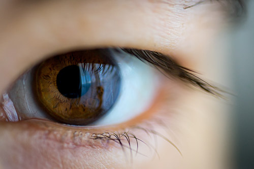 Jaga Penglihatan Anda: Memahami Beragam Jenis Kerusakan Retina Mata dan Cara Pencegahannya