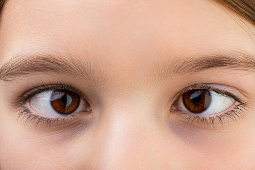 Mata Juling (Strabismus): Kenali Penyebab, Gejala, dan Cara Pengobatan yang Tepat