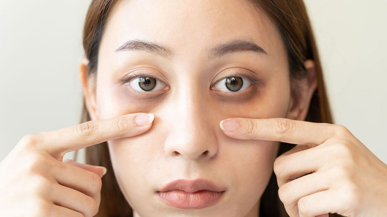 Cara Efektif Mengatasi Mata Panda: Pahami Penyebab dan Solusi Terbaik