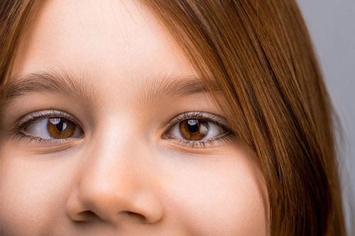 Mata Malas (Amblyopia): Kenali Gejala, Penyebab, dan Cara Mengobati pada Anak